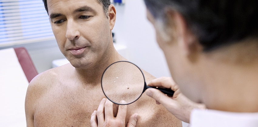 a dermatologist investigating squamous cell carcinoma on a male patient's shoulder